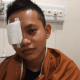 Pelajar asal Morut ini harus kehilangan mata kanannya. Saat selesai berobat, ia dan keluarganya dihadapkan persoalan biaya pengobatan seebsar Rp42 juta. (Foto: IST).