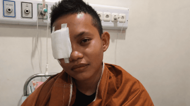Pelajar asal Morut ini harus kehilangan mata kanannya. Saat selesai berobat, ia dan keluarganya dihadapkan persoalan biaya pengobatan seebsar Rp42 juta. (Foto: IST).