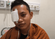 Pelajar asal Morut ini harus kehilangan mata kanannya. Saat selesai berobat, ia dan keluarganya dihadapkan persoalan biaya pengobatan seebsar Rp42 juta. (Foto: IST).