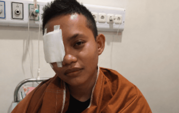 Pelajar asal Morut ini harus kehilangan mata kanannya. Saat selesai berobat, ia dan keluarganya dihadapkan persoalan biaya pengobatan seebsar Rp42 juta. (Foto: IST).