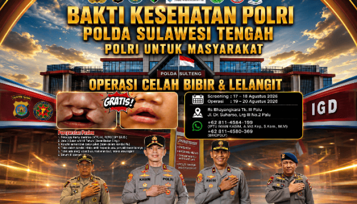 Polri Gelar Operasi Celah Bibir dan Lelangit Gratis di Palu, Screening Dibuka 17–18 Agustus