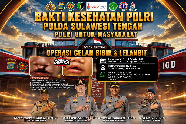 Polri Gelar Operasi Celah Bibir dan Lelangit Gratis di Palu, Screening Dibuka 17–18 Agustus